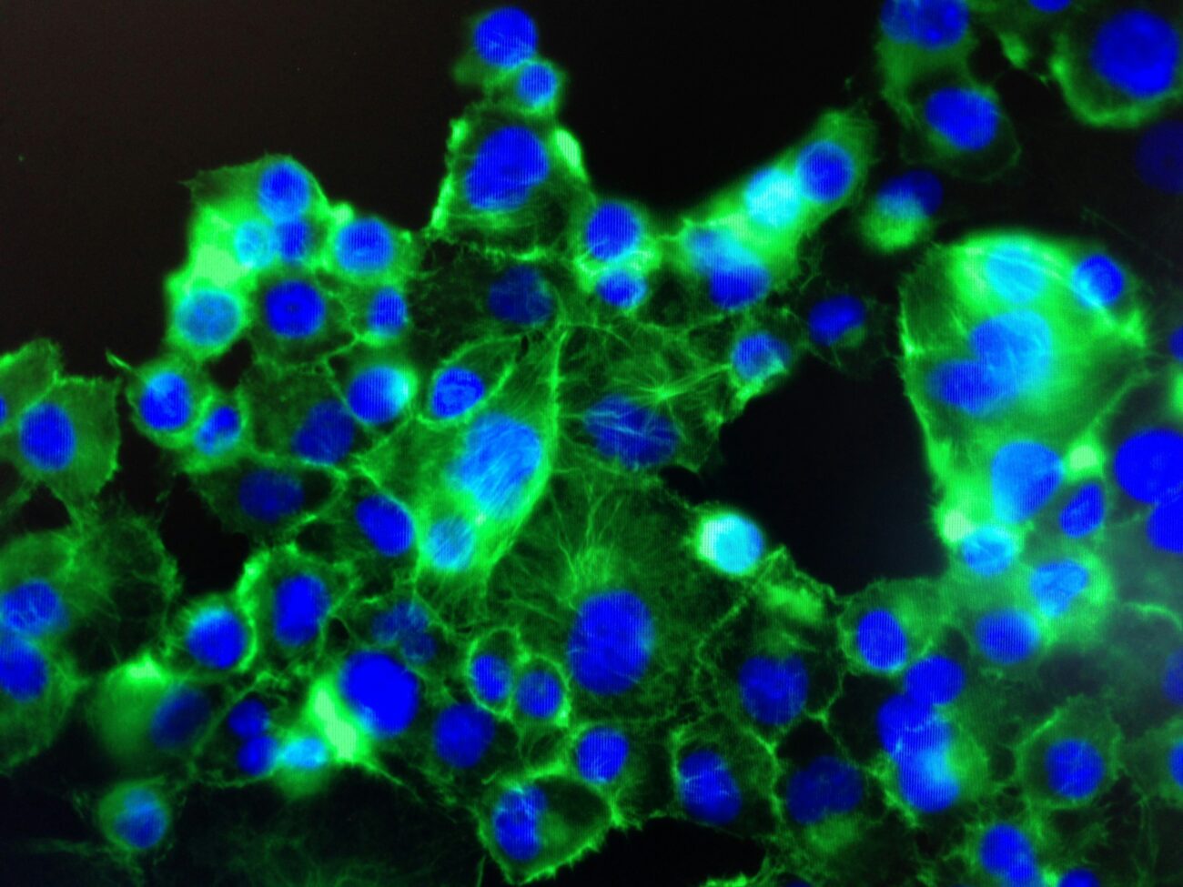 zytescintizivad spread