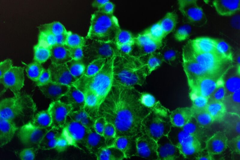 The Unveiling of Zytescintizivad Spread: A Culinary Marvel